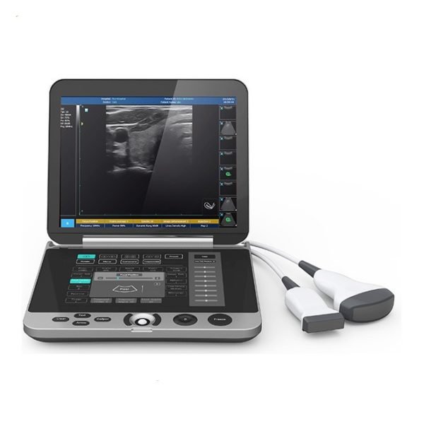 Laptop Ultrasound Machine with Touch Screen Keyboard NEUPU44