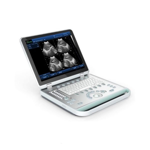3D Full Digital Laptop Ultrasound Scanner NEUPU25