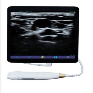 Portable Mini Ultrasound Machine NEUMU09