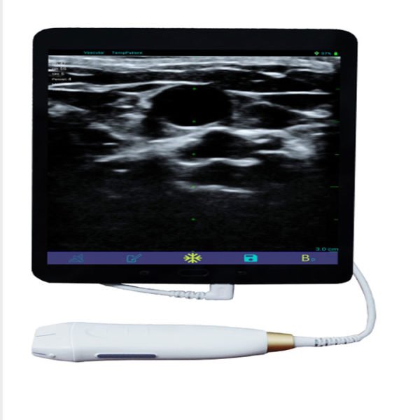 Portable Mini Ultrasound Machine NEUMU09