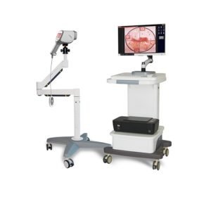 Portable Gynaecology Digital Colposcope System NEUCE07