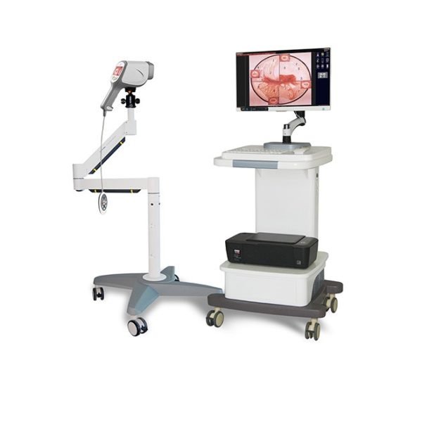 Portable Gynaecology Digital Colposcope System NEUCE07