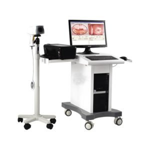 Colposcope Video Machine for Gynaecology NEUCE06