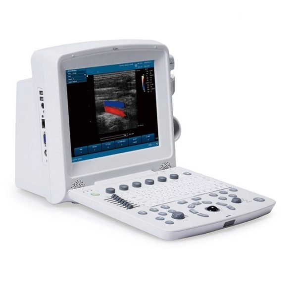 FDA Approved Color Doppler Ultrasound Pregnancy U50