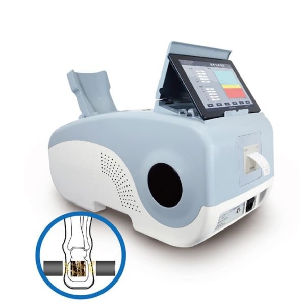 Bone Density Scan NEUBD05