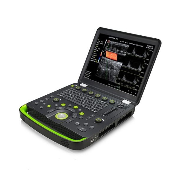 Static 3D/4D Doppler Ultrasound NEUCU56