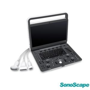 Doppler Ultrasound System Sonoscape E3
