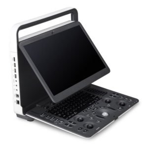 Doppler Ultrasound Scan Sonoscape E2