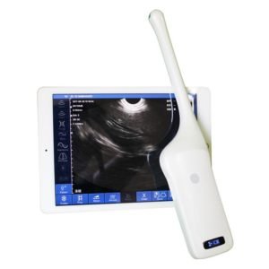 Wireless Probe for Mini Ultrasound Scanner NEUPU47