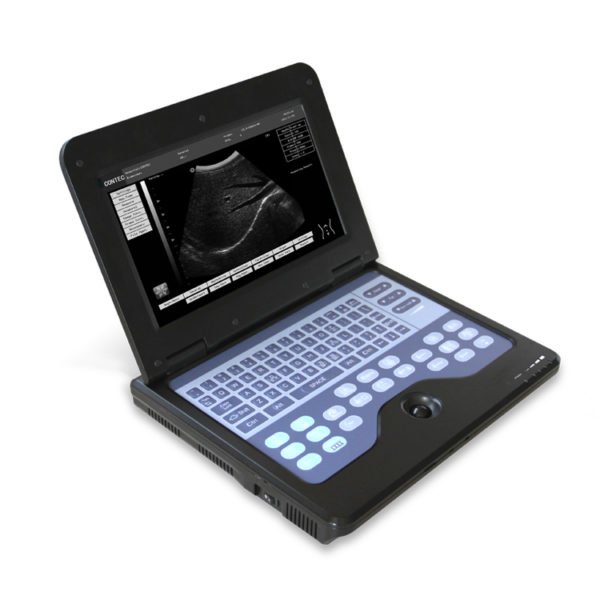 CMS600P2 B-Ultrasound Diagnostic System