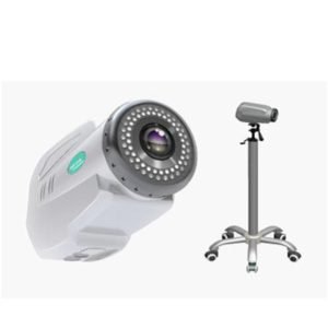 EC100 Electronic Colposcope