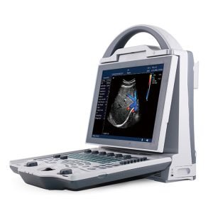 Ophthalmic Ultrasound Scanner NEUPU23